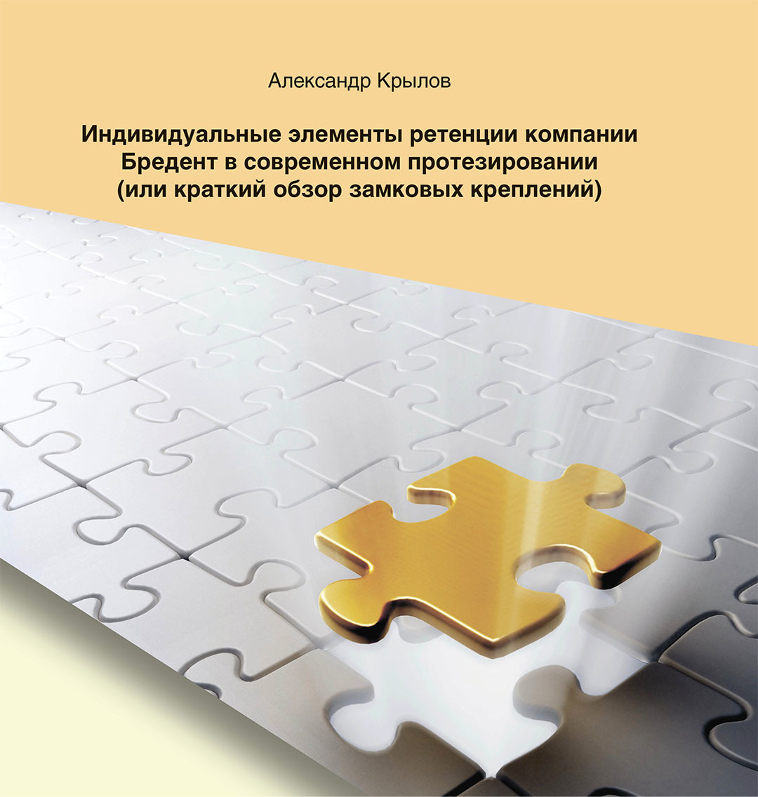 Индивидуальный элемент. Аладент Бредент. Мартиньони точная припасовка несъемных протезов. Точная припасовка несъемных протезов Мартиньони Шоненбергер. В индивидуальном элементе l.